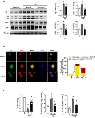 Metformin-Enhanced Cardiac AMP-Activated Protein Kinase/Atrogin-1 Pathways Inhibit Charged Multivesicular Body Protein 2B Accumulation in Ischemia–Reperfusion Injury